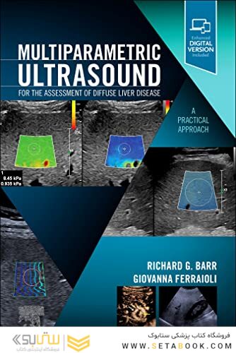 Multiparametric Ultrasound for the Assessment of Diffuse Liver Disease : A Practical Approach 2023
