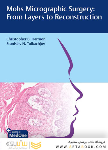 Mohs Micrographic Surgery: From Layers to Reconstruction 1st Edicion 2023