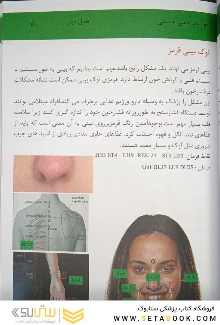 اولین مرجع طب سوزنی زیبایی صورت 2022