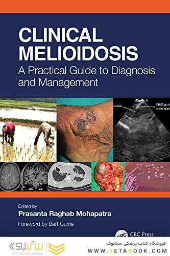 Clinical Melioidosis: A Practical Guide to Diagnosis and Management 1st Edition
