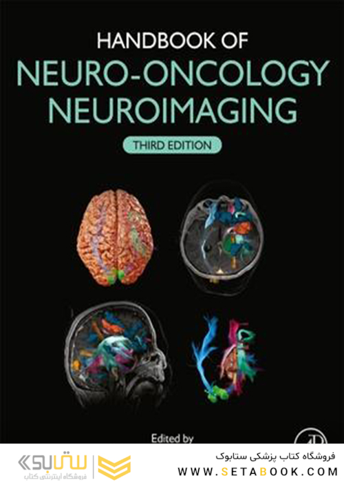 Handbook of Neuro-Oncology Neuroimaging 3rd Edition