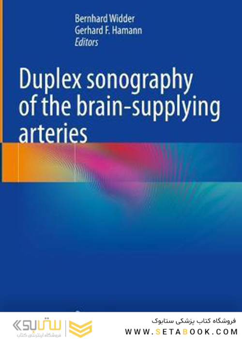Duplex sonography of the brain-supplying arteries Kindle Edition