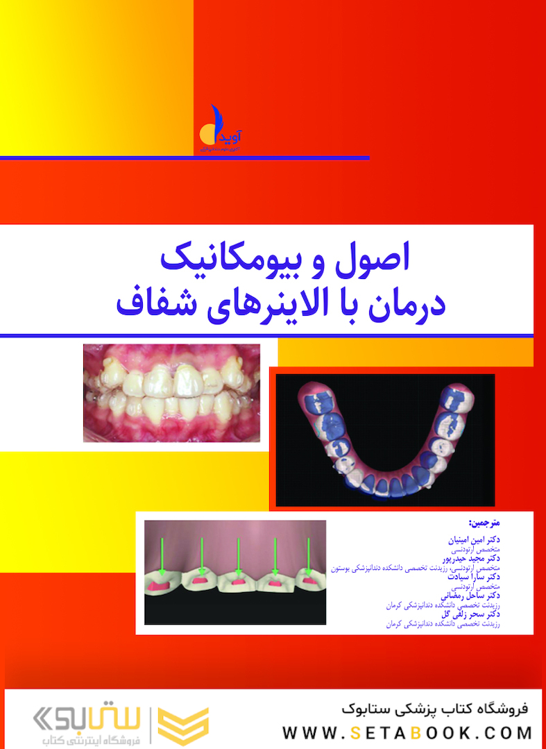 اصول و بیومکانیک درمان با الاینرهای شفاف