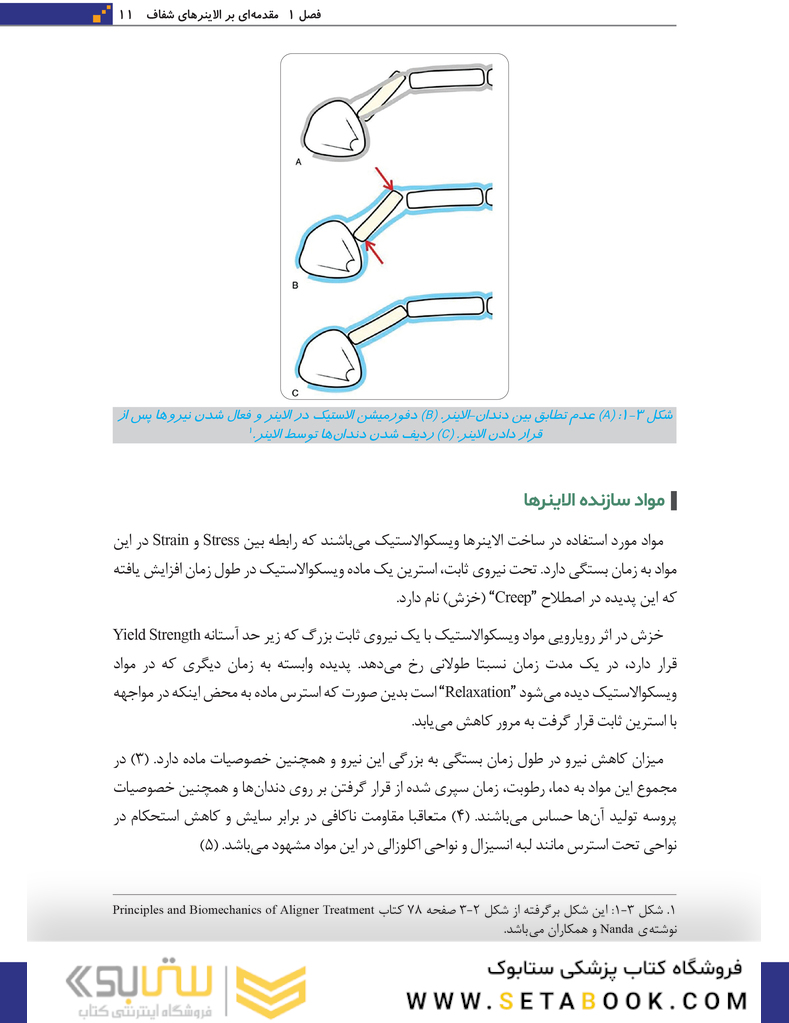 مبانی اتچمنت ها در سیستم ارتودنسی شفاف