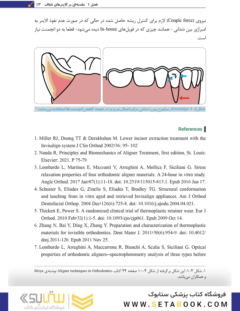 مبانی اتچمنت ها در سیستم ارتودنسی شفاف