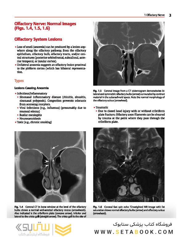 Cranial Nerves: Anatomy, Pathology, Imaging
