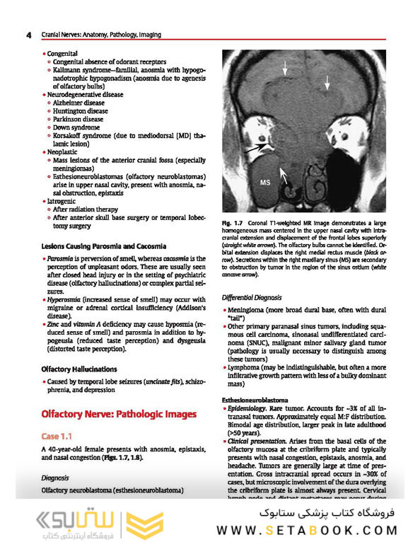 Cranial Nerves: Anatomy, Pathology, Imaging