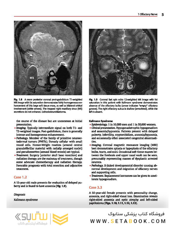 Cranial Nerves: Anatomy, Pathology, Imaging