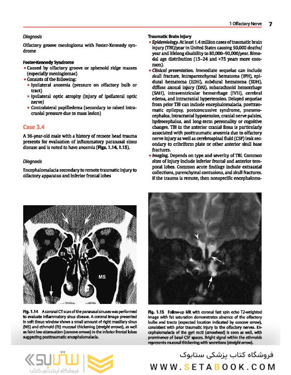 Cranial Nerves: Anatomy, Pathology, Imaging