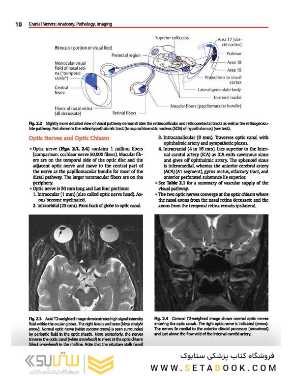 Cranial Nerves: Anatomy, Pathology, Imaging