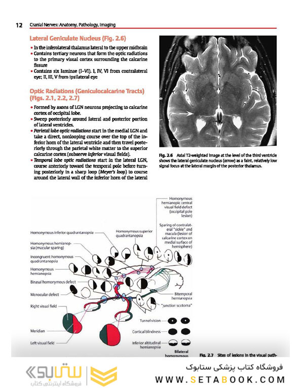 Cranial Nerves: Anatomy, Pathology, Imaging