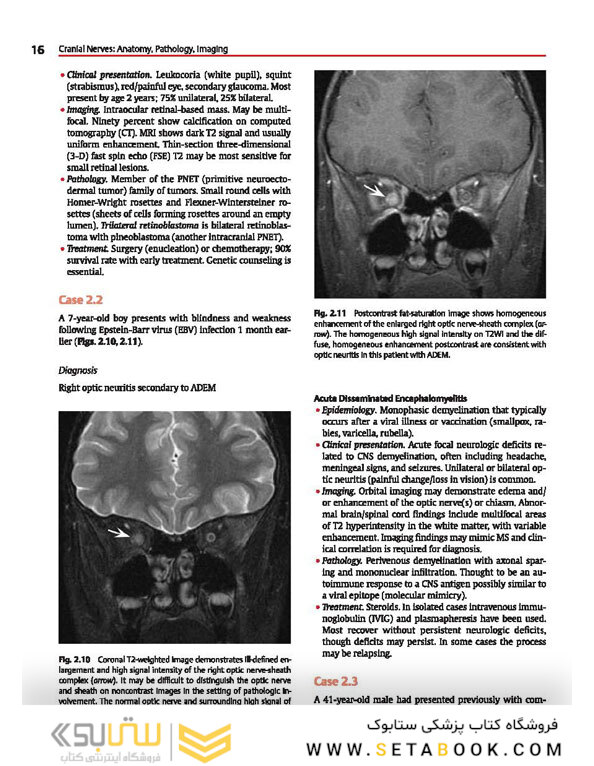 Cranial Nerves: Anatomy, Pathology, Imaging