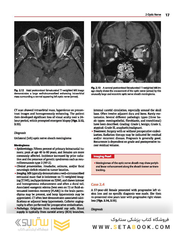 Cranial Nerves: Anatomy, Pathology, Imaging
