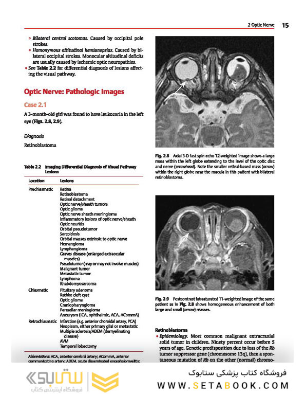 Cranial Nerves: Anatomy, Pathology, Imaging
