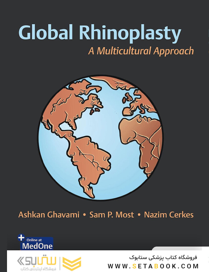 Global Rhinoplasty: A Multicultural Approach 1st Edicion 2023
