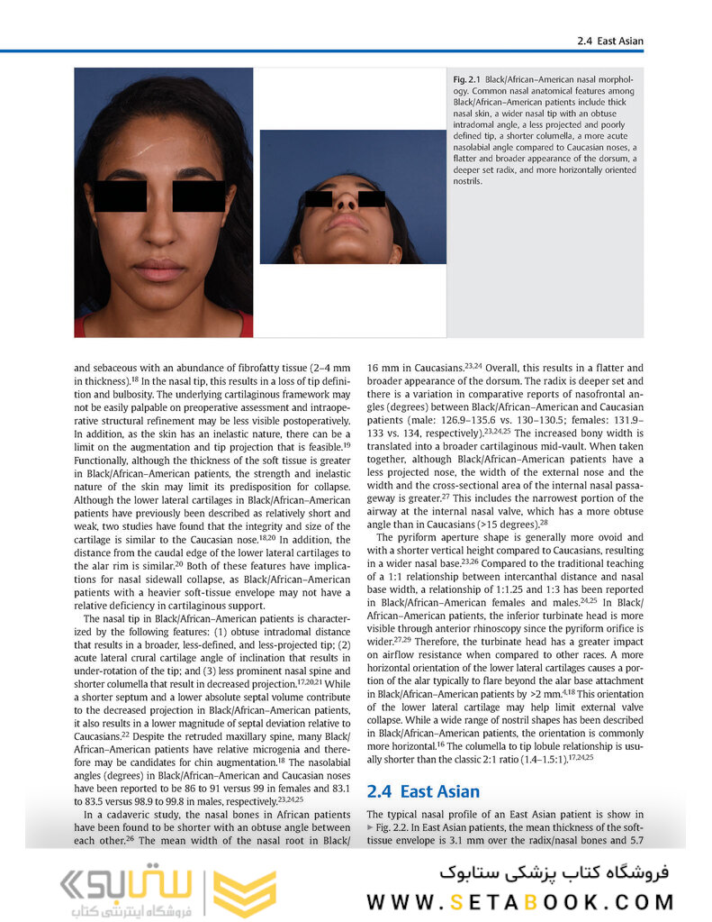 Global Rhinoplasty: A Multicultural Approach 1st Edicion 2023