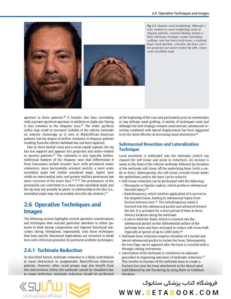 Global Rhinoplasty: A Multicultural Approach 1st Edicion 2023
