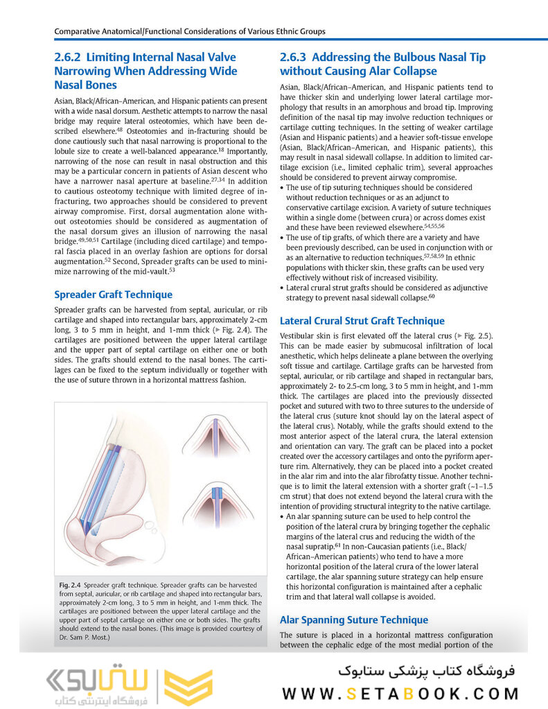 Global Rhinoplasty: A Multicultural Approach 1st Edicion 2023