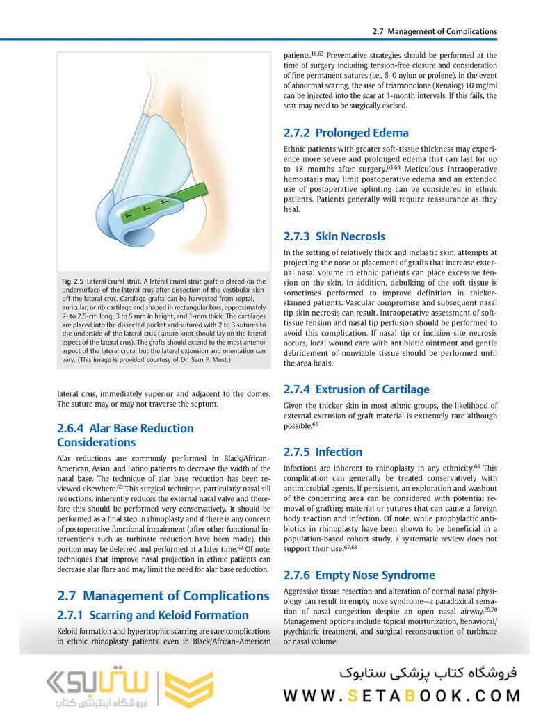 Global Rhinoplasty: A Multicultural Approach 1st Edicion 2023
