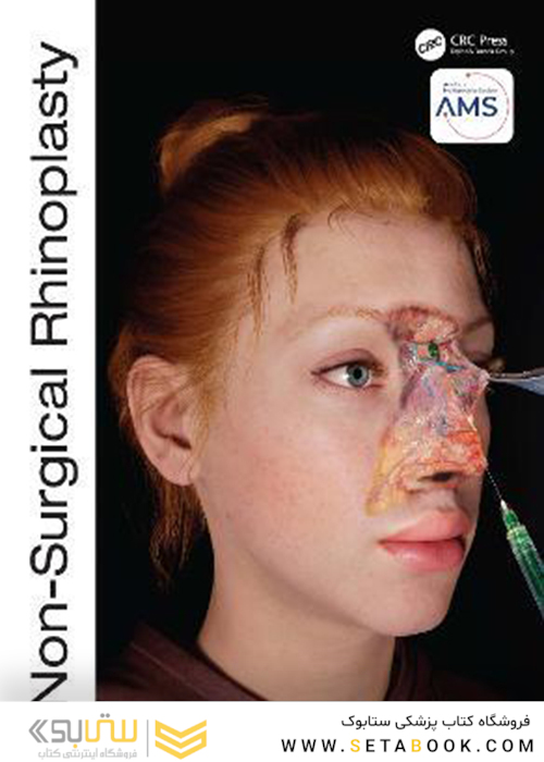 Non-Surgical Rhinoplasty (The PRIME Series) Kindle Edition