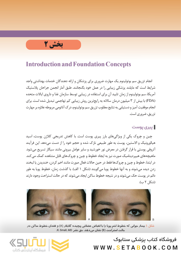 راهنمای عملی روش های بوتولینوم توکسین