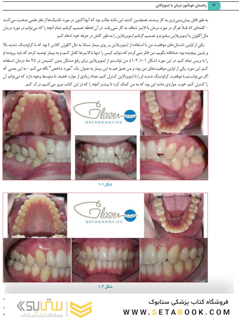 راهنمای خودآموز درمان با اینویزالاین راهنمای گام به گام برای برنامه های درمانی کلینچک
