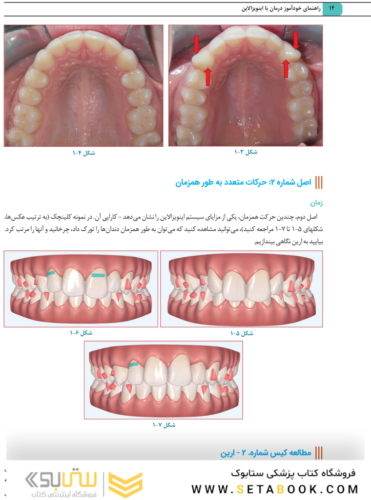 راهنمای خودآموز درمان با اینویزالاین راهنمای گام به گام برای برنامه های درمانی کلینچک