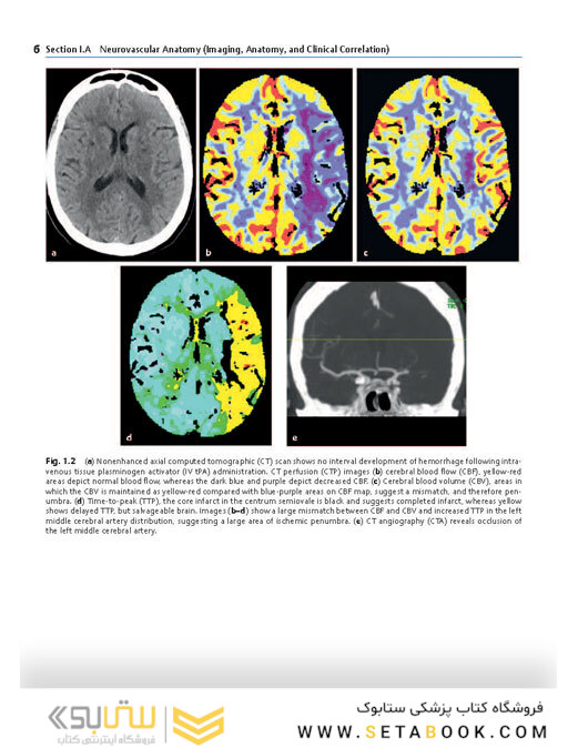 Neurosurgery Knowledge Update : A Comprehensive Review 2015