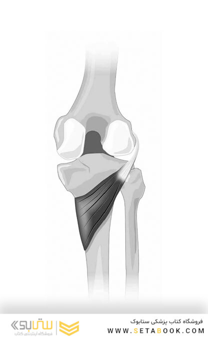 Solving the Pain Puzzle: Cases from 25 Years as a Physical Therapist Paperback