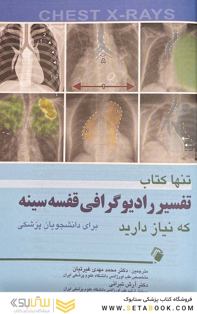 تنها کتاب تفسیر رادیوگرافی قفسه سینه که نیاز دارید