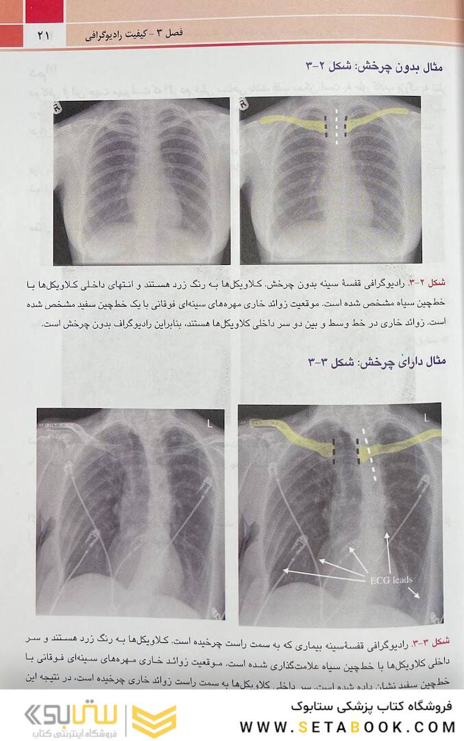 تنها کتاب تفسیر رادیوگرافی قفسه سینه که نیاز دارید