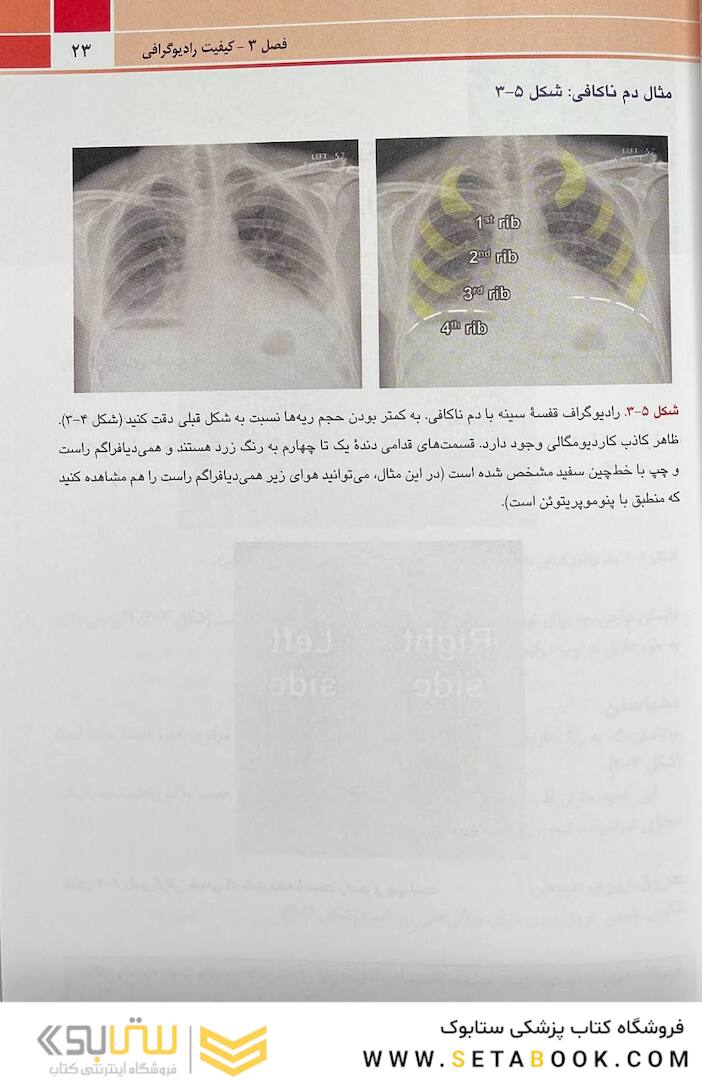 تنها کتاب تفسیر رادیوگرافی قفسه سینه که نیاز دارید
