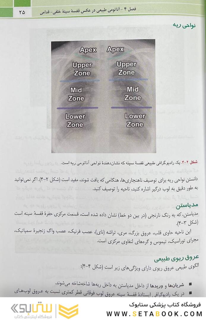 تنها کتاب تفسیر رادیوگرافی قفسه سینه که نیاز دارید