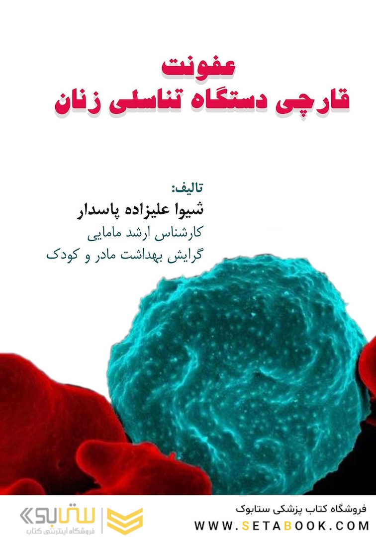 عفونت قارچی دستگاه تناسلی زنان