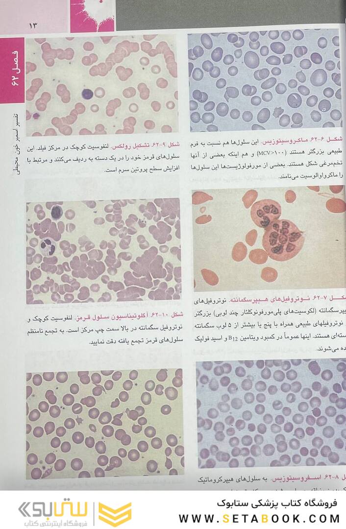 اصول طب داخلی هاریسون بیماری  های هماتولوژی 2022