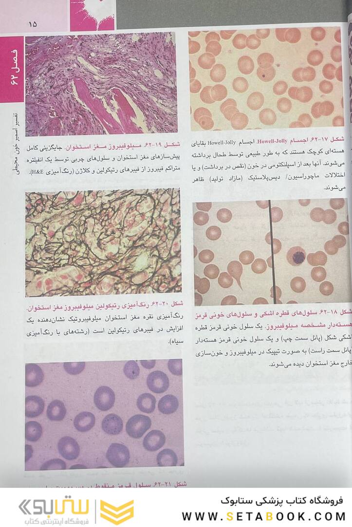 اصول طب داخلی هاریسون بیماری  های هماتولوژی 2022