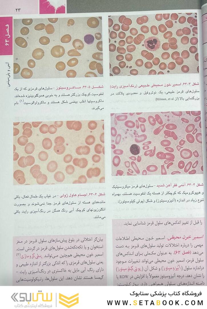 اصول طب داخلی هاریسون بیماری  های هماتولوژی 2022