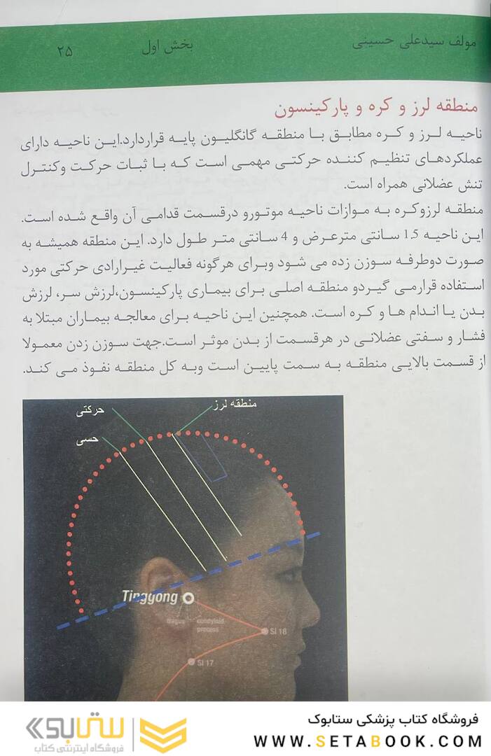 اولین مرجع طب سوزنی اسکالپ 2022
