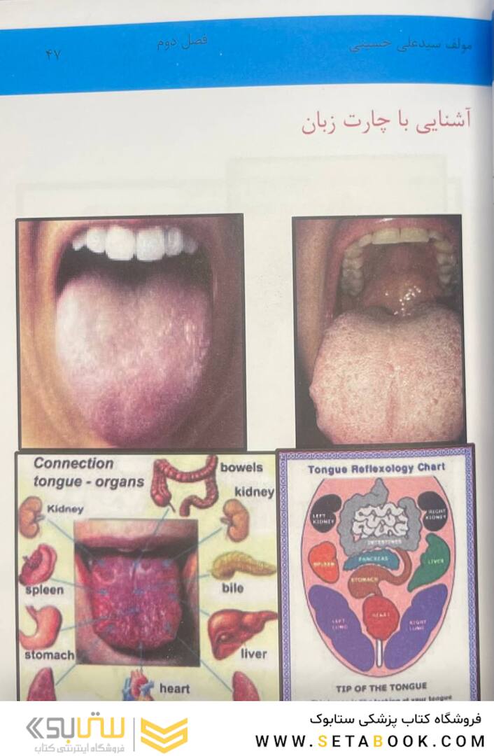 اولین مرجع تشخیص بیماری از روی زبان 2022