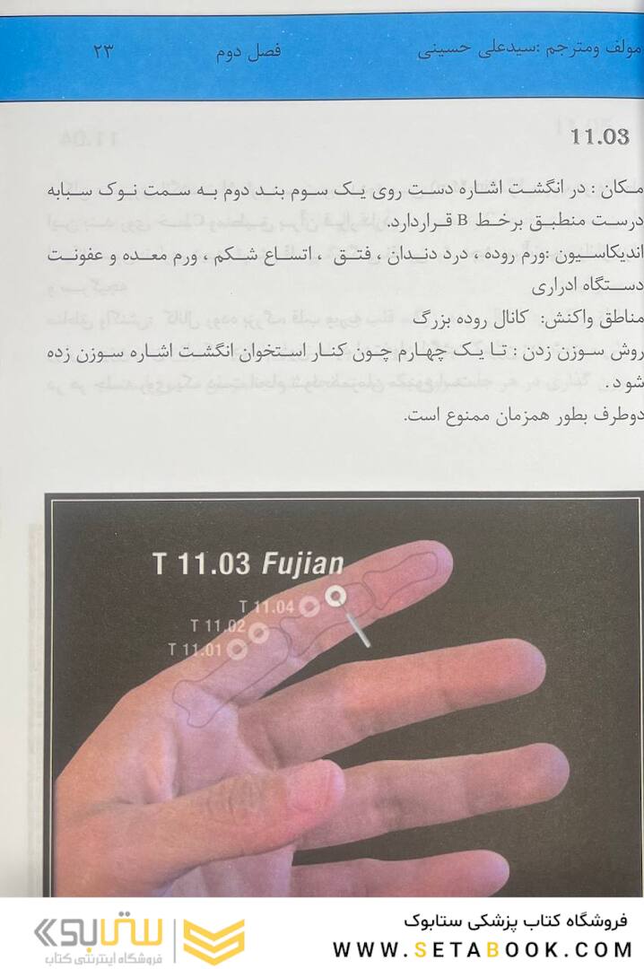 اولین مرجع طب سوزنی مستر تانگ 2022