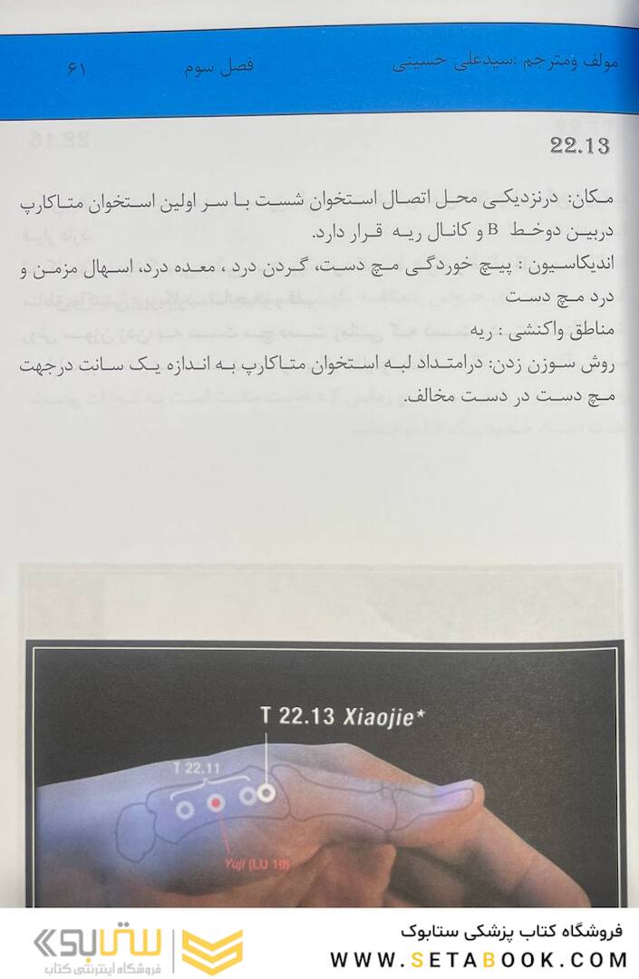 اولین مرجع طب سوزنی مستر تانگ 2022