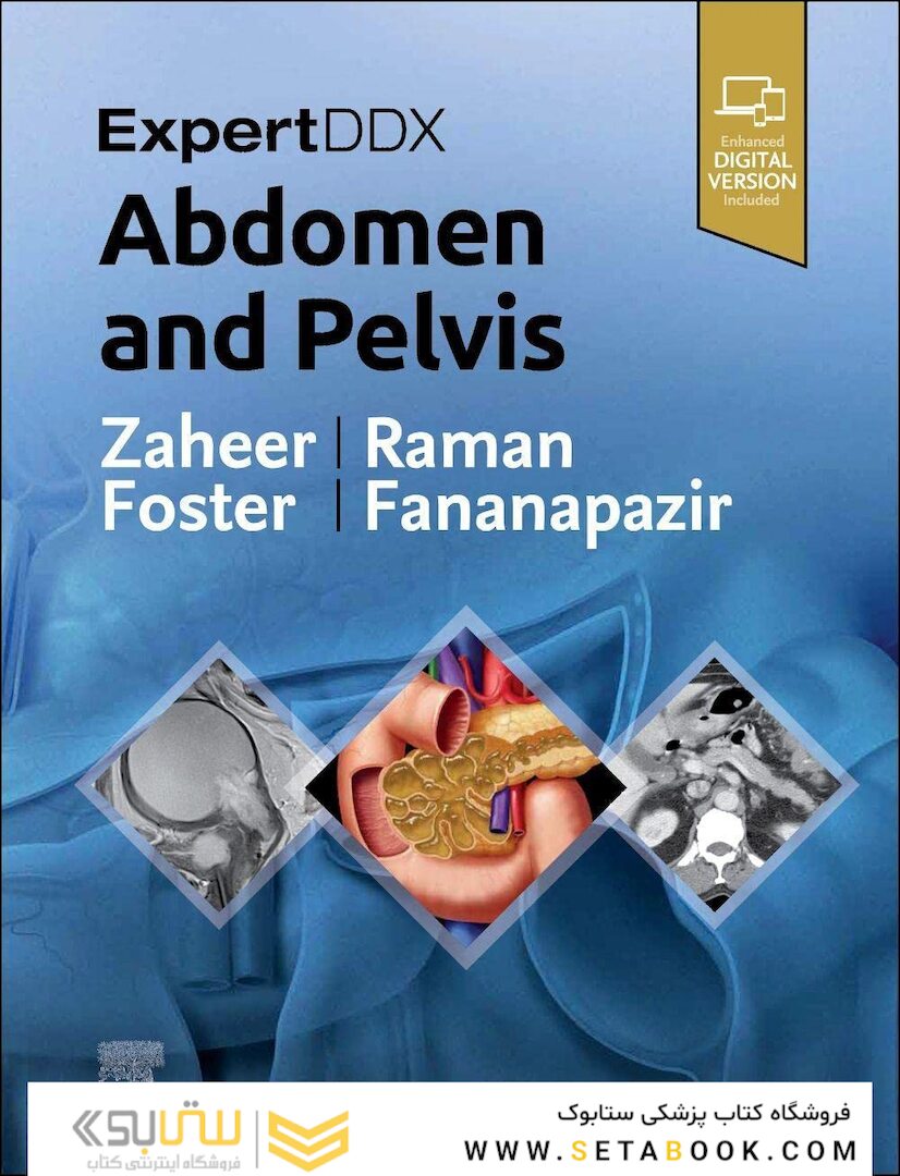 ExpertDDx: Abdomen and Pelvis, 3rd Edition 2023