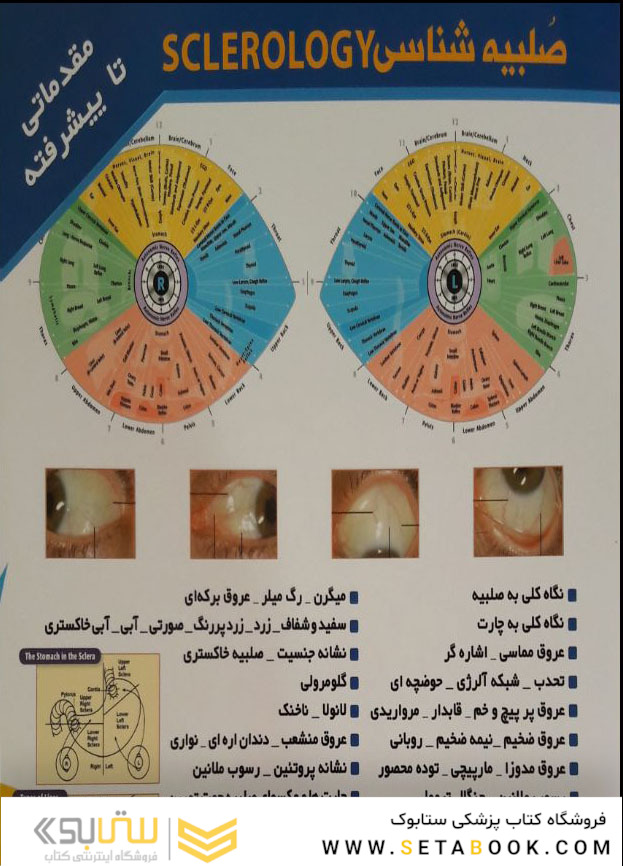 آموزش تشخیص بیماری از روی صلبیه چشم (برای اندروید)