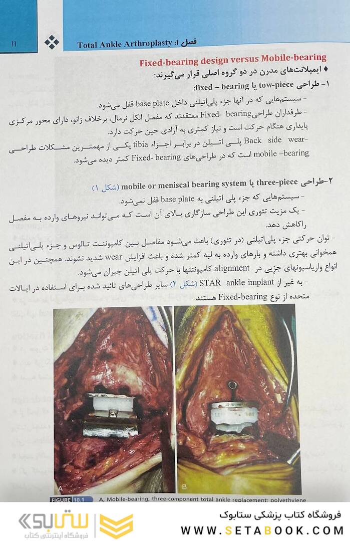 انکل - کمپل 2021