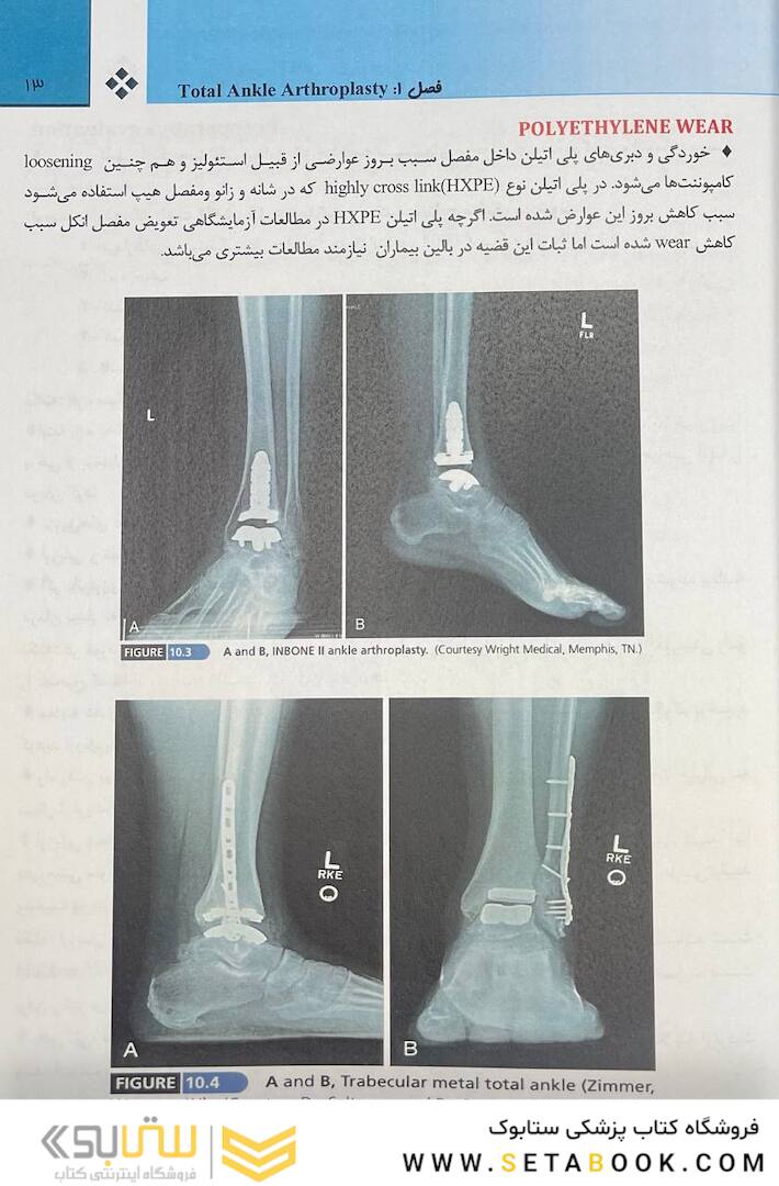 انکل - کمپل 2021