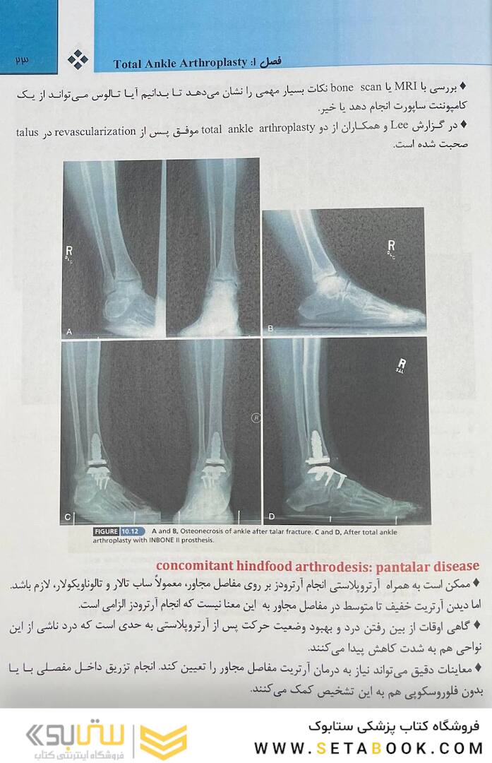 انکل - کمپل 2021