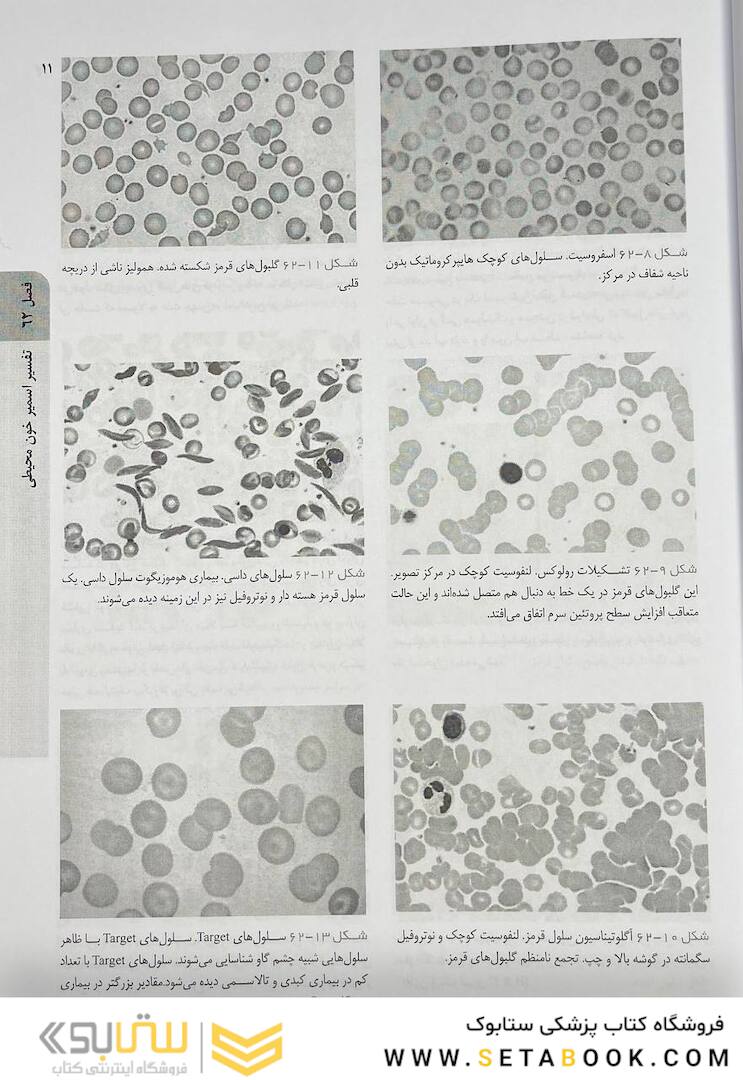 اصول طب داخلی هاریسون هماتولوژی 2022