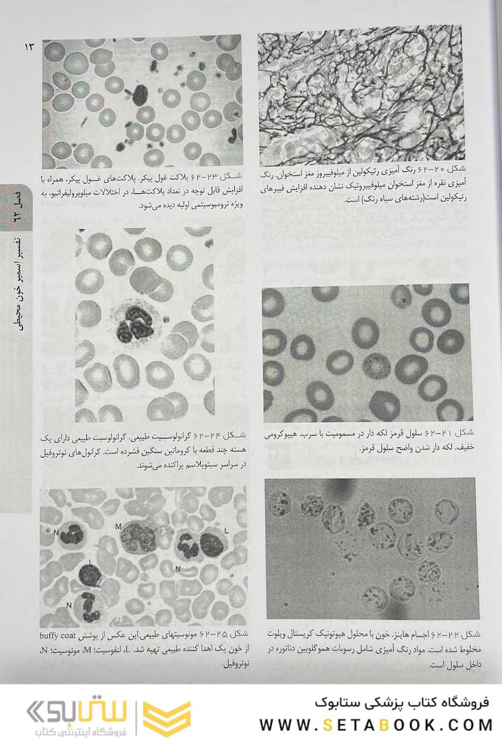 اصول طب داخلی هاریسون هماتولوژی 2022