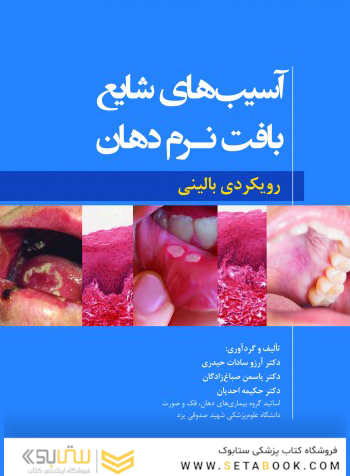 آسیب های شایع بافت نرم دهان رویکردی بالینی