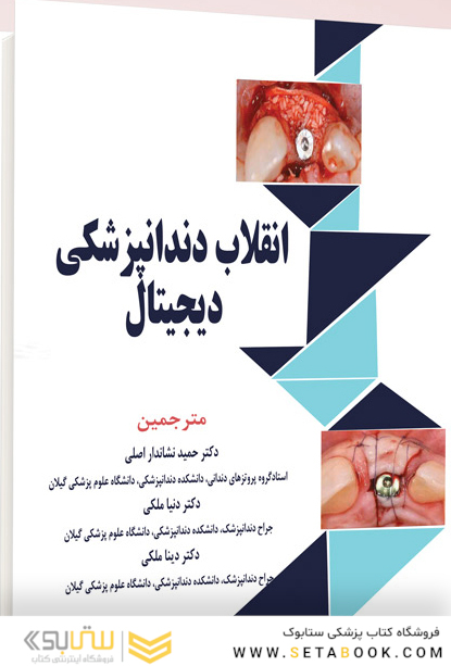 انقلاب دندانپزشکی دیجیتال